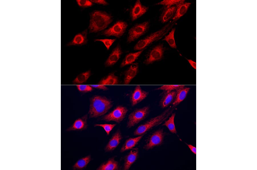 Immunofluorescence - Anti-GAMT Antibody (A9930) - Antibodies.com