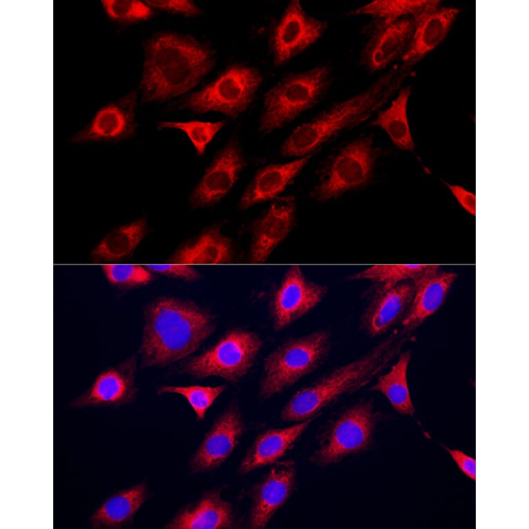 Immunofluorescence - Anti-GAMT Antibody (A9930) - Antibodies.com