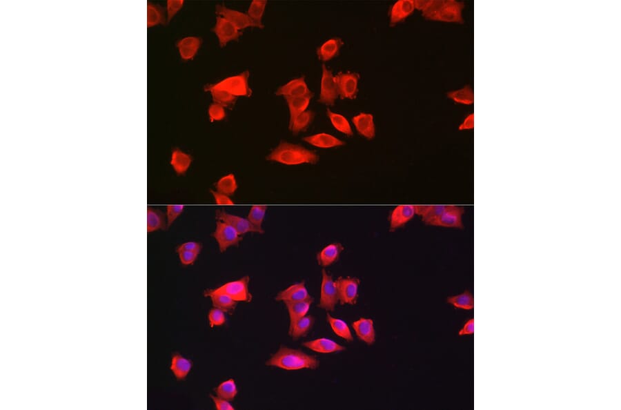Immunofluorescence - Anti-GAMT Antibody (A9930) - Antibodies.com