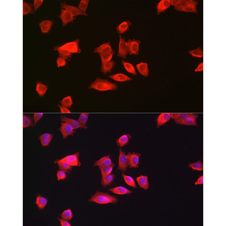 Immunofluorescence - Anti-GAMT Antibody (A9930) - Antibodies.com