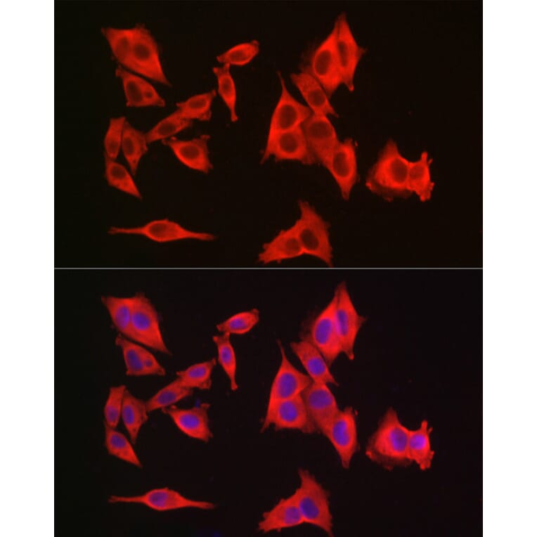 Immunofluorescence - Anti-GAMT Antibody (A9930) - Antibodies.com