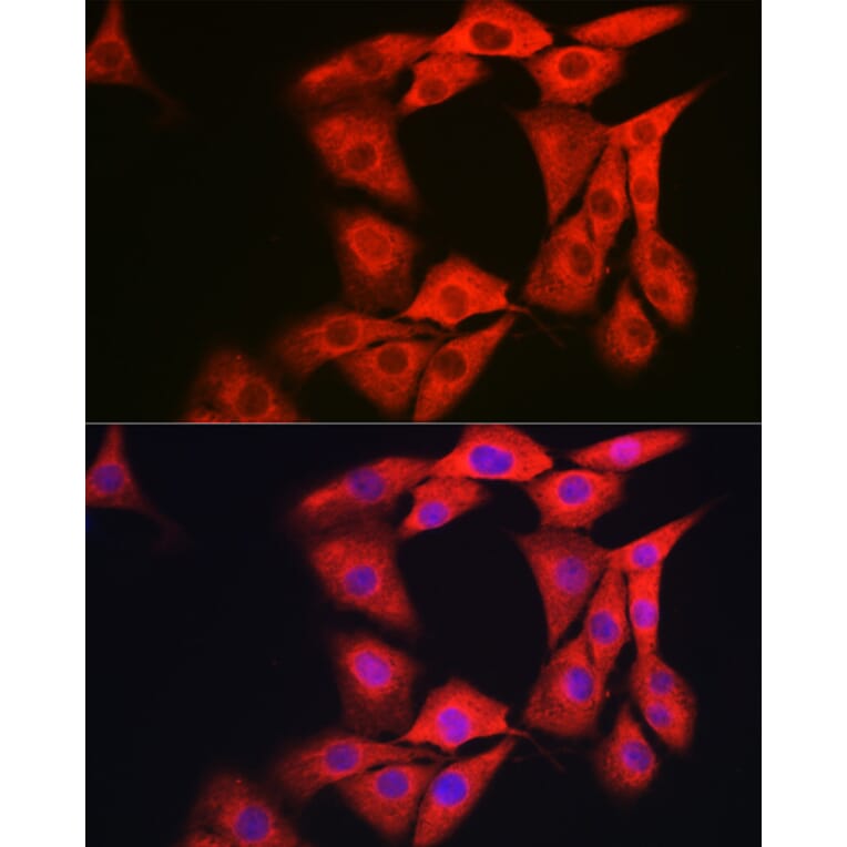 Immunofluorescence - Anti-GAMT Antibody (A9930) - Antibodies.com