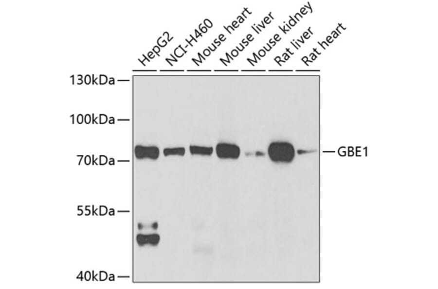 Western Blot - Anti-GBE1 Antibody (A9931) - Antibodies.com