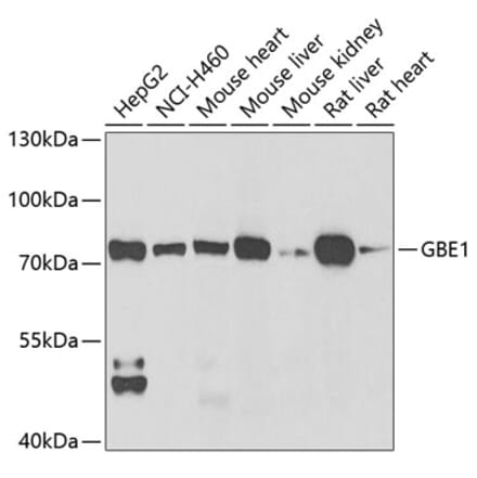 Western Blot - Anti-GBE1 Antibody (A9931) - Antibodies.com