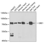 Western Blot - Anti-GBE1 Antibody (A9931) - Antibodies.com