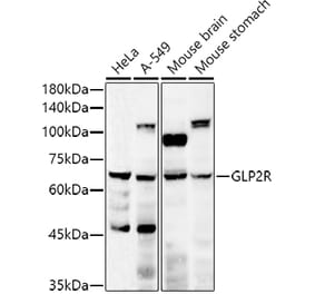 Western Blot - Anti-GLP2R Antibody (A9933) - Antibodies.com
