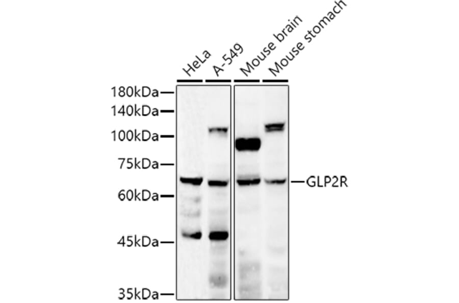 Western Blot - Anti-GLP2R Antibody (A9933) - Antibodies.com