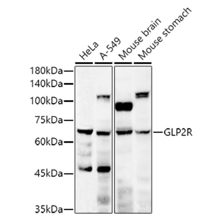 Western Blot - Anti-GLP2R Antibody (A9933) - Antibodies.com