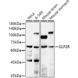 Western Blot - Anti-GLP2R Antibody (A9933) - Antibodies.com