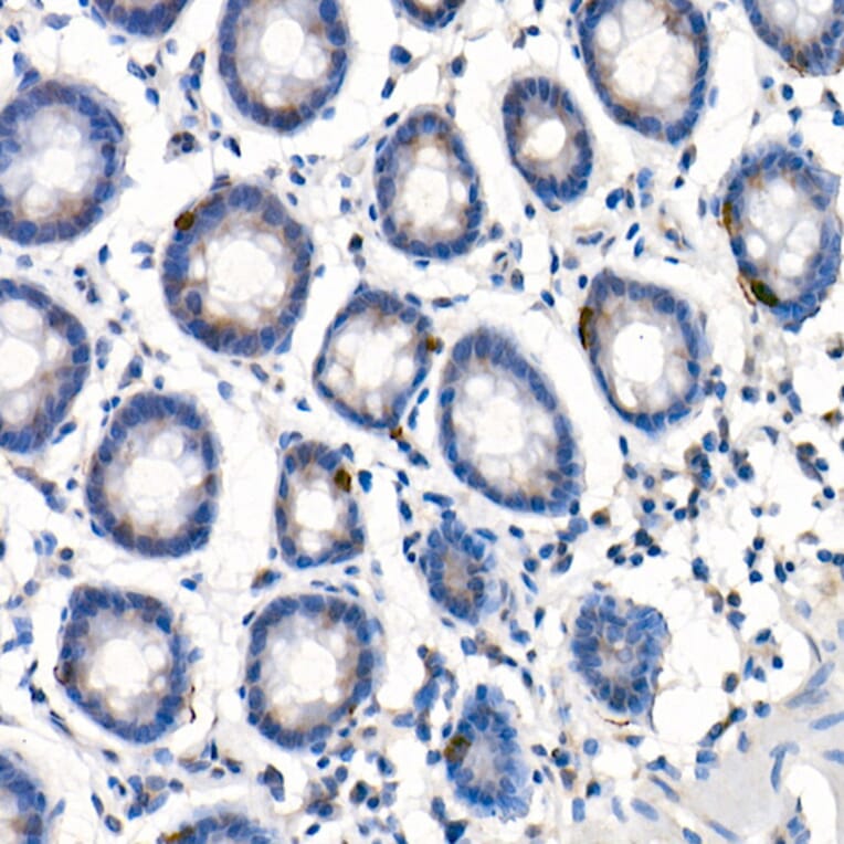 Immunohistochemistry - Anti-GLP2R Antibody (A9933) - Antibodies.com