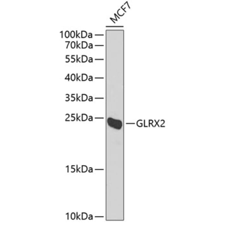 Western Blot - Anti-GLRX2 Antibody (A6603) - Antibodies.com