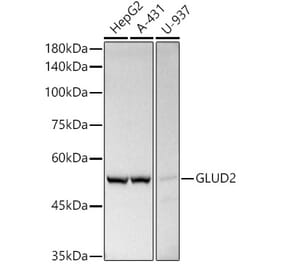 Western Blot - Anti-GLUD2 Antibody (A9935) - Antibodies.com