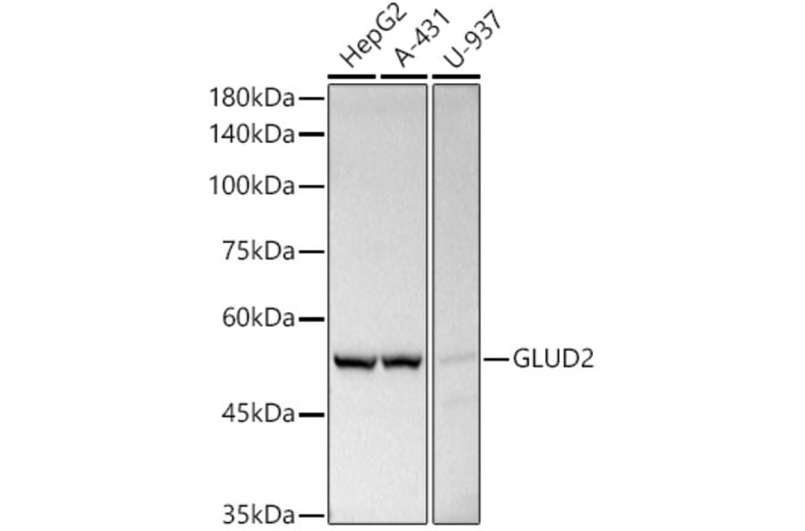 Western Blot - Anti-GLUD2 Antibody (A9935) - Antibodies.com