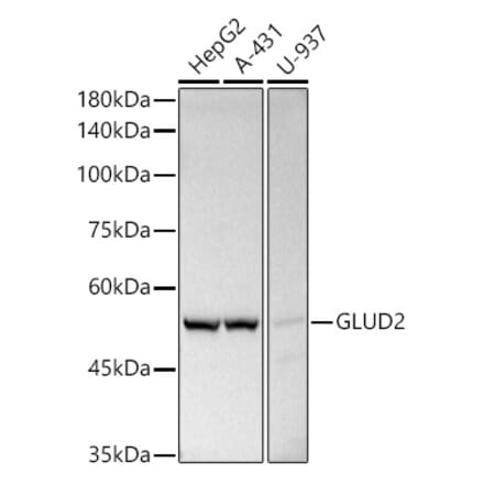 Western Blot - Anti-GLUD2 Antibody (A9935) - Antibodies.com