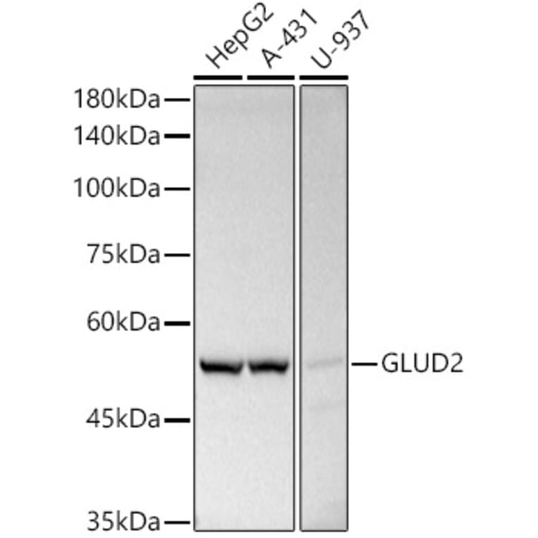 Western Blot - Anti-GLUD2 Antibody (A9935) - Antibodies.com