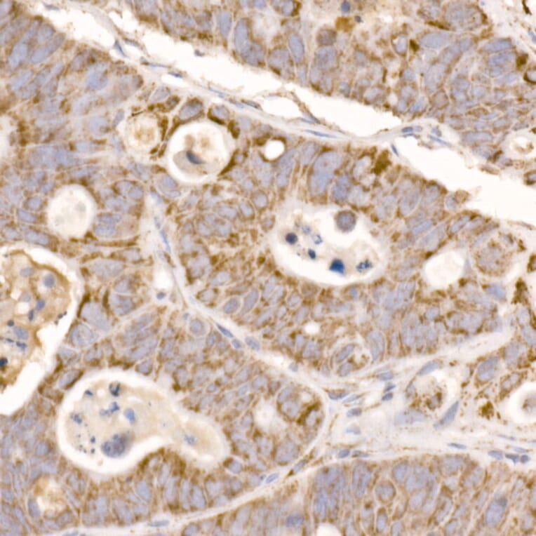 Immunohistochemistry - Anti-GLUD2 Antibody (A9935) - Antibodies.com