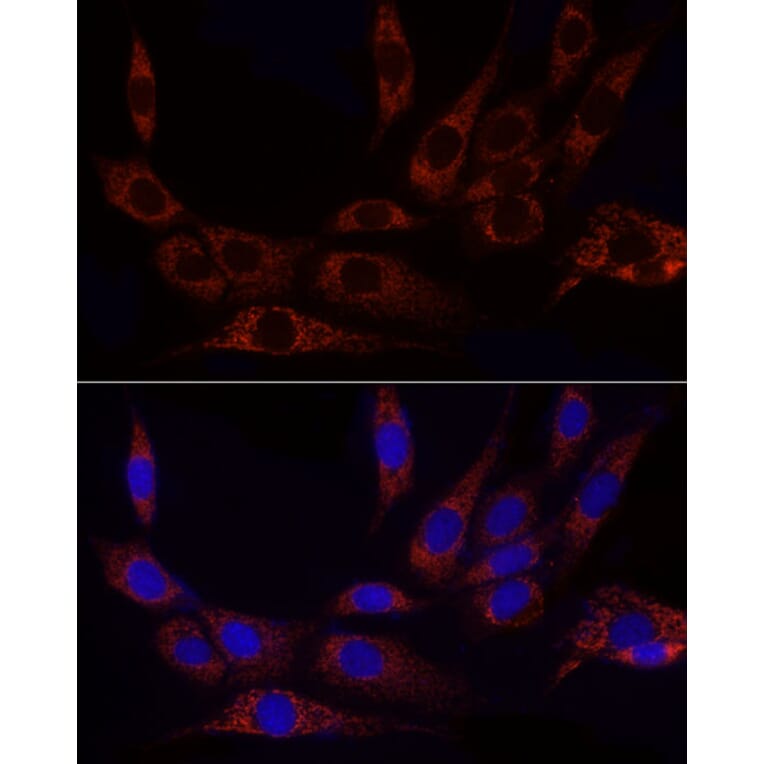 Immunofluorescence - Anti-GLUD2 Antibody (A9935) - Antibodies.com