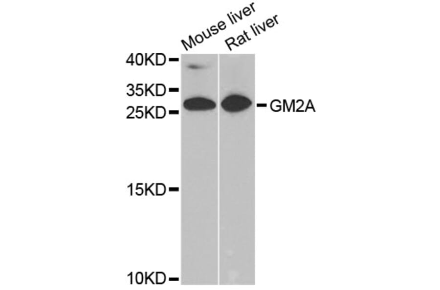 Western Blot - Anti-GM2A Antibody (A6605) - Antibodies.com