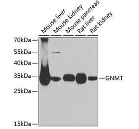 Western Blot - Anti-GNMT Antibody (A9938) - Antibodies.com