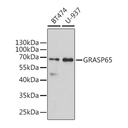 Western Blot - Anti-GRASP65 Antibody (A9939) - Antibodies.com