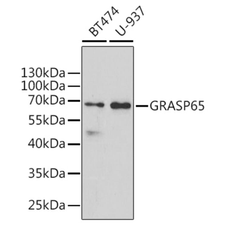 Western Blot - Anti-GRASP65 Antibody (A9939) - Antibodies.com