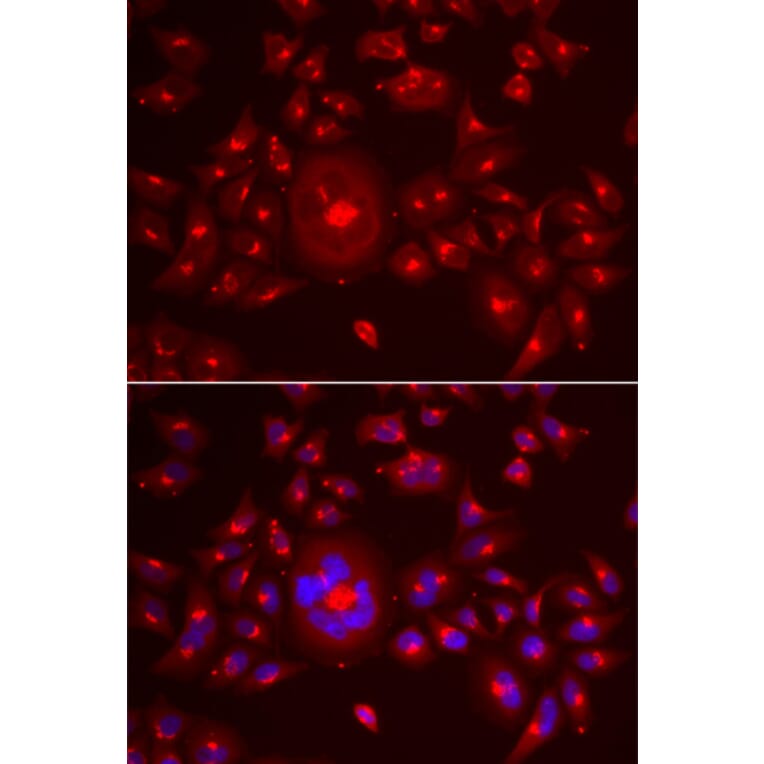 Immunofluorescence - Anti-GRASP65 Antibody (A9939) - Antibodies.com