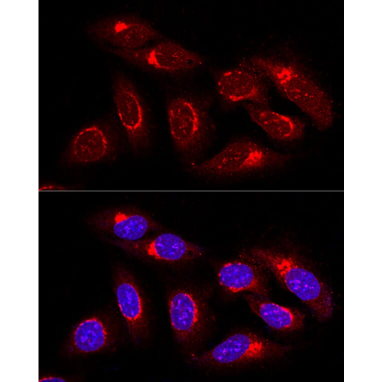 Immunofluorescence - Anti-GRASP65 Antibody (A9939) - Antibodies.com