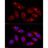 Immunofluorescence - Anti-GRASP65 Antibody (A9939) - Antibodies.com