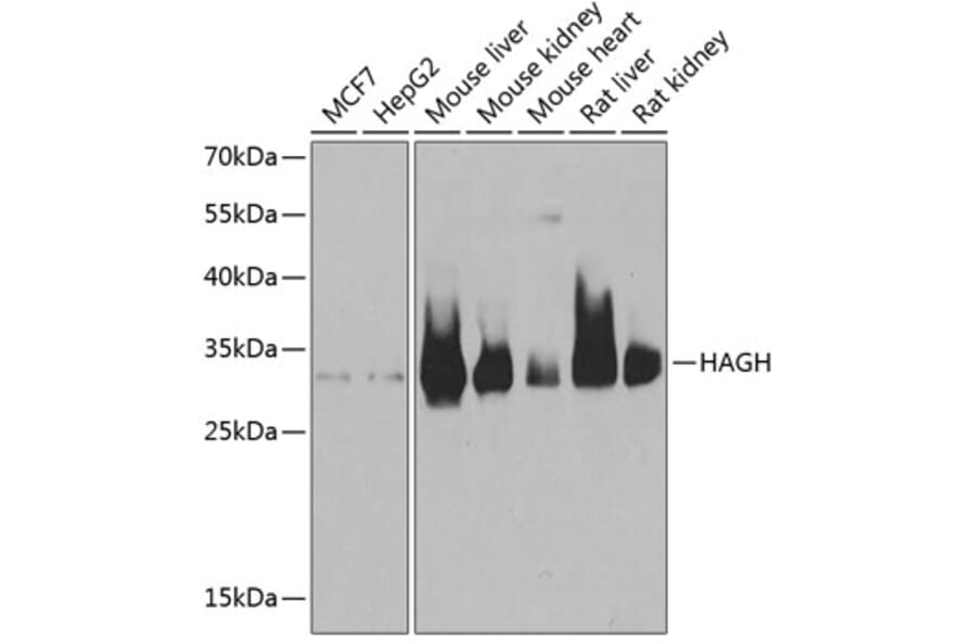 Western Blot - Anti-HAGH Antibody (A9940) - Antibodies.com