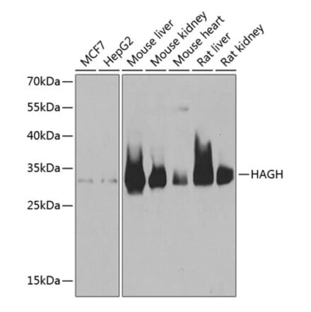Western Blot - Anti-HAGH Antibody (A9940) - Antibodies.com