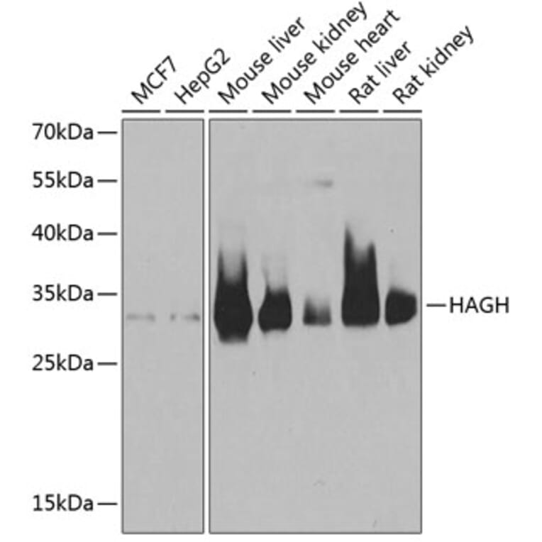 Western Blot - Anti-HAGH Antibody (A9940) - Antibodies.com
