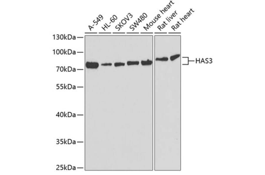 Western Blot - Anti-HAS3 Antibody (A9941) - Antibodies.com