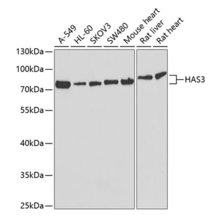 Western Blot - Anti-HAS3 Antibody (A9941) - Antibodies.com