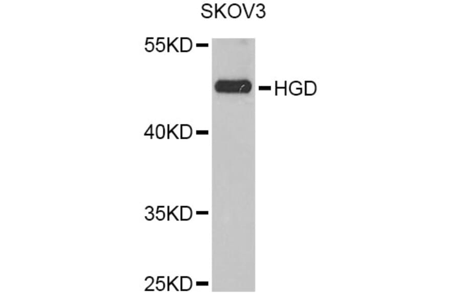 Western Blot - Anti-HGD Antibody (A6618) - Antibodies.com