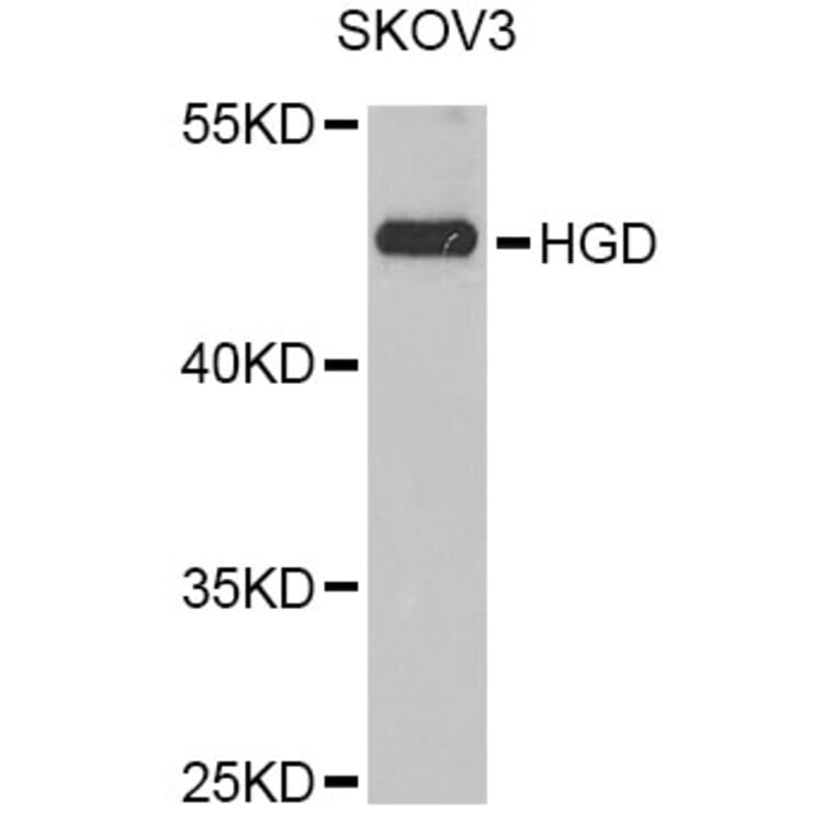 Western Blot - Anti-HGD Antibody (A6618) - Antibodies.com