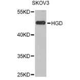 Western Blot - Anti-HGD Antibody (A6618) - Antibodies.com