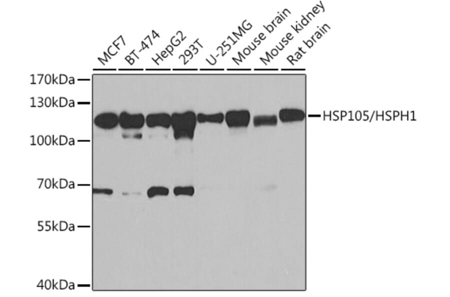 Western Blot - Anti-Hsp105/HSP110 Antibody (A9944) - Antibodies.com