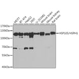 Western Blot - Anti-Hsp105/HSP110 Antibody (A9944) - Antibodies.com