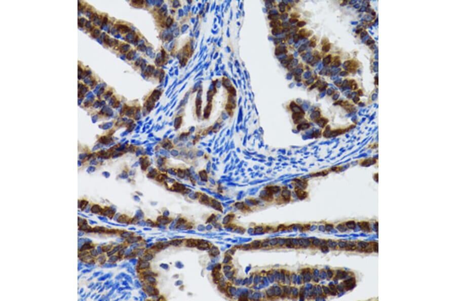 Immunohistochemistry - Anti-Hsp105/HSP110 Antibody (A9944) - Antibodies.com