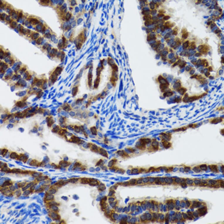 Immunohistochemistry - Anti-Hsp105/HSP110 Antibody (A9944) - Antibodies.com