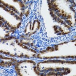 Immunohistochemistry - Anti-Hsp105/HSP110 Antibody (A9944) - Antibodies.com
