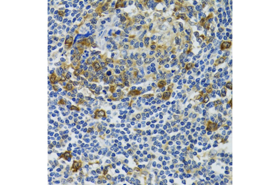 Immunohistochemistry - Anti-Hsp105/HSP110 Antibody (A9944) - Antibodies.com