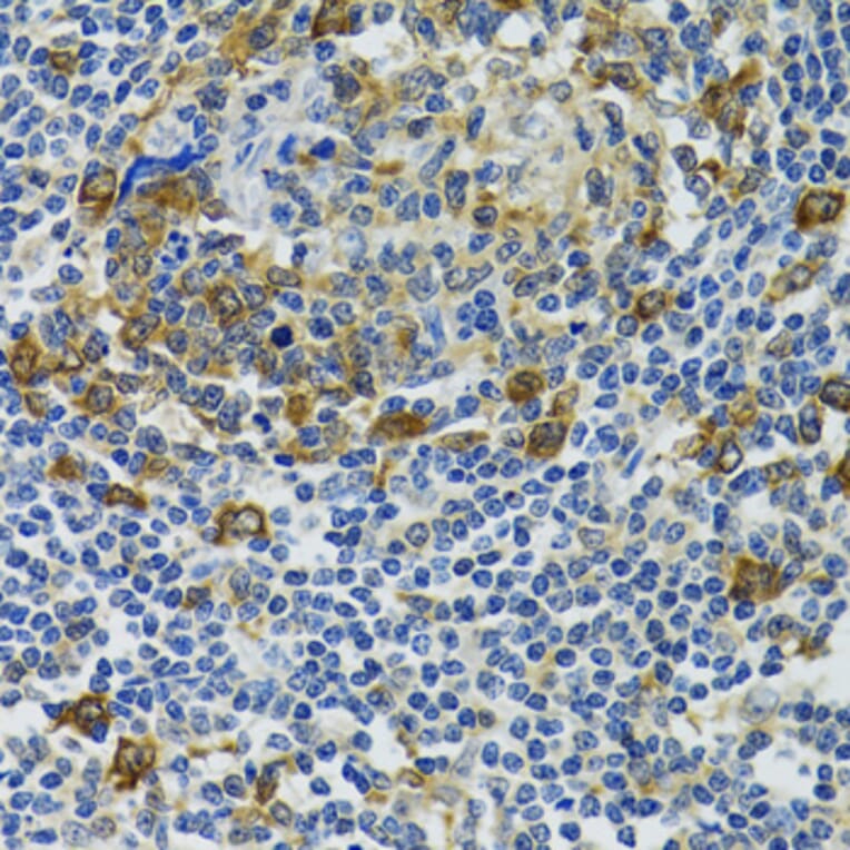 Immunohistochemistry - Anti-Hsp105/HSP110 Antibody (A9944) - Antibodies.com