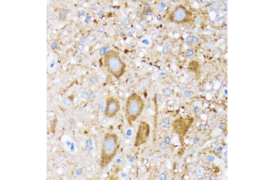 Immunohistochemistry - Anti-Hsp105/HSP110 Antibody (A9944) - Antibodies.com