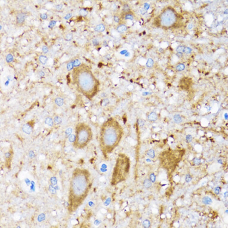 Immunohistochemistry - Anti-Hsp105/HSP110 Antibody (A9944) - Antibodies.com