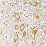 Immunohistochemistry - Anti-Hsp105/HSP110 Antibody (A9944) - Antibodies.com