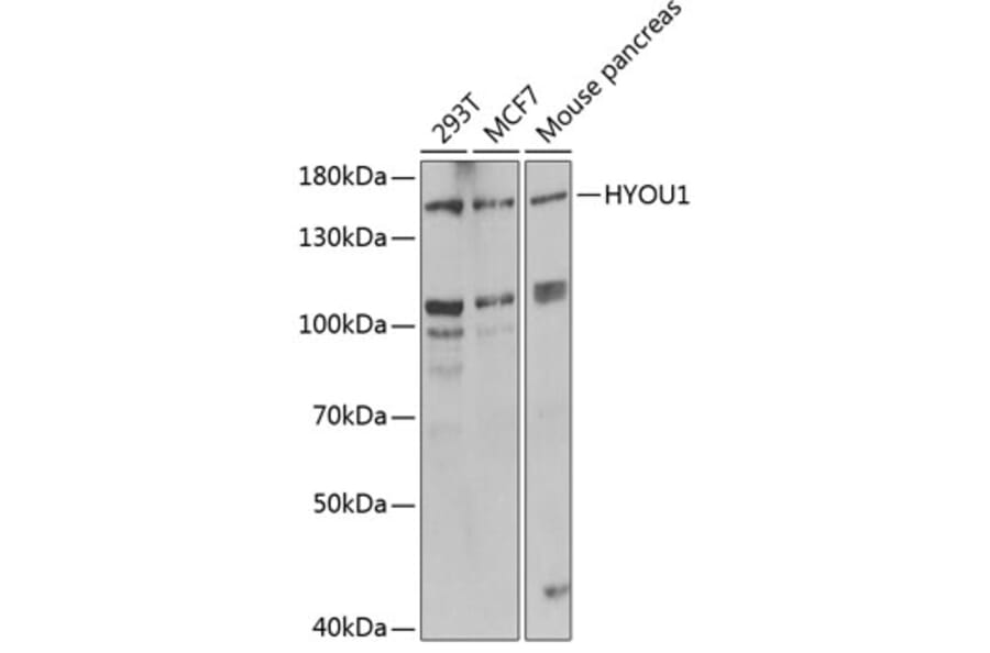 Western Blot - Anti-HYOU1 Antibody (A6625) - Antibodies.com