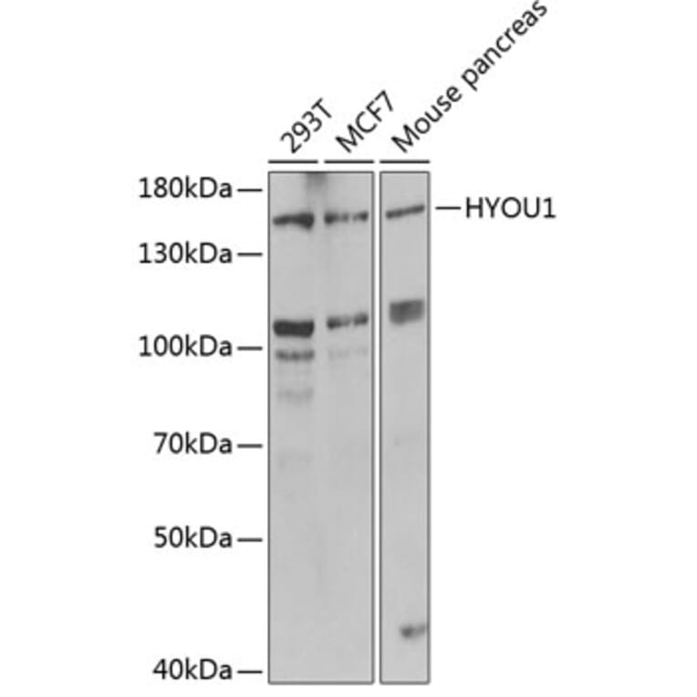 Western Blot - Anti-HYOU1 Antibody (A6625) - Antibodies.com