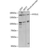 Western Blot - Anti-HYOU1 Antibody (A6625) - Antibodies.com