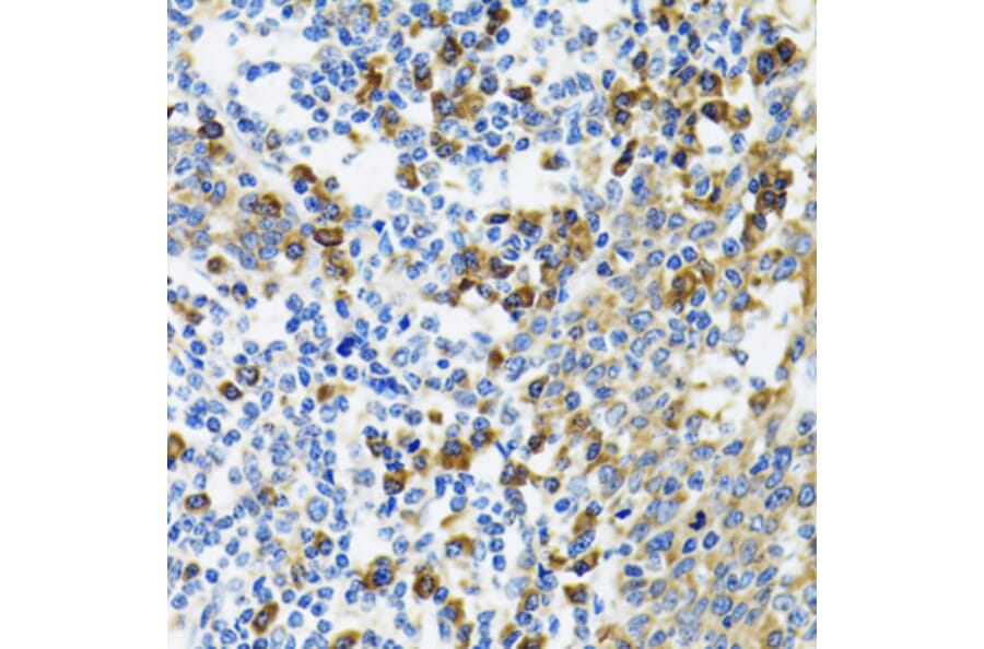 Immunohistochemistry - Anti-HYOU1 Antibody (A6625) - Antibodies.com